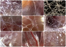Understanding the Myofascial Web: A Comprehensive Guide