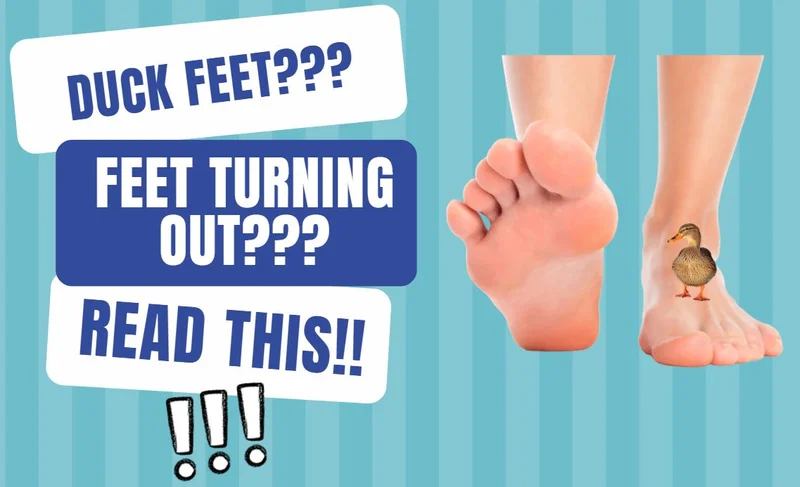 Do You Have ‘Duck Feet’?