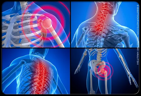 Fibromyalgia
